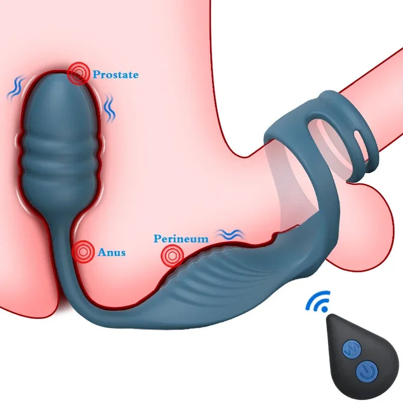 Prostata-Massagegerät mit Penisring, vibrierender Buttplug, Analvibrator, kabellose Fernbedienung, Sexspielzeug, Analdildo-Stimulator für Männer und Frauen